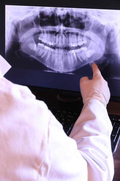 Best Emergency Denture Repair in Fillmore, UT
